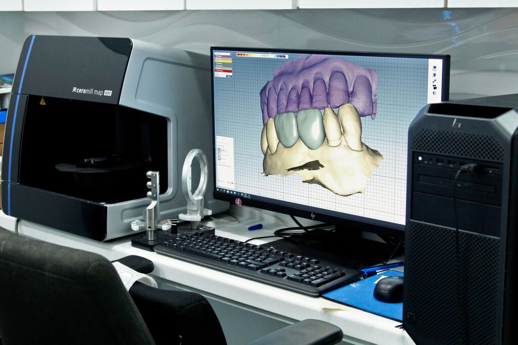 Digital Dental Design Services